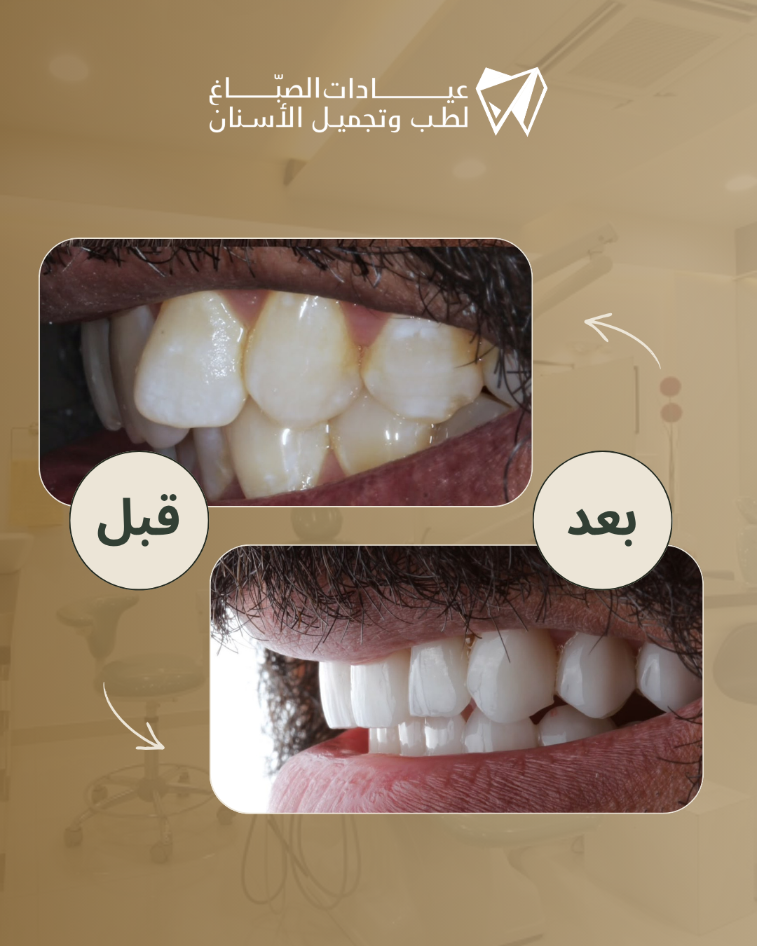الحالة الأولى