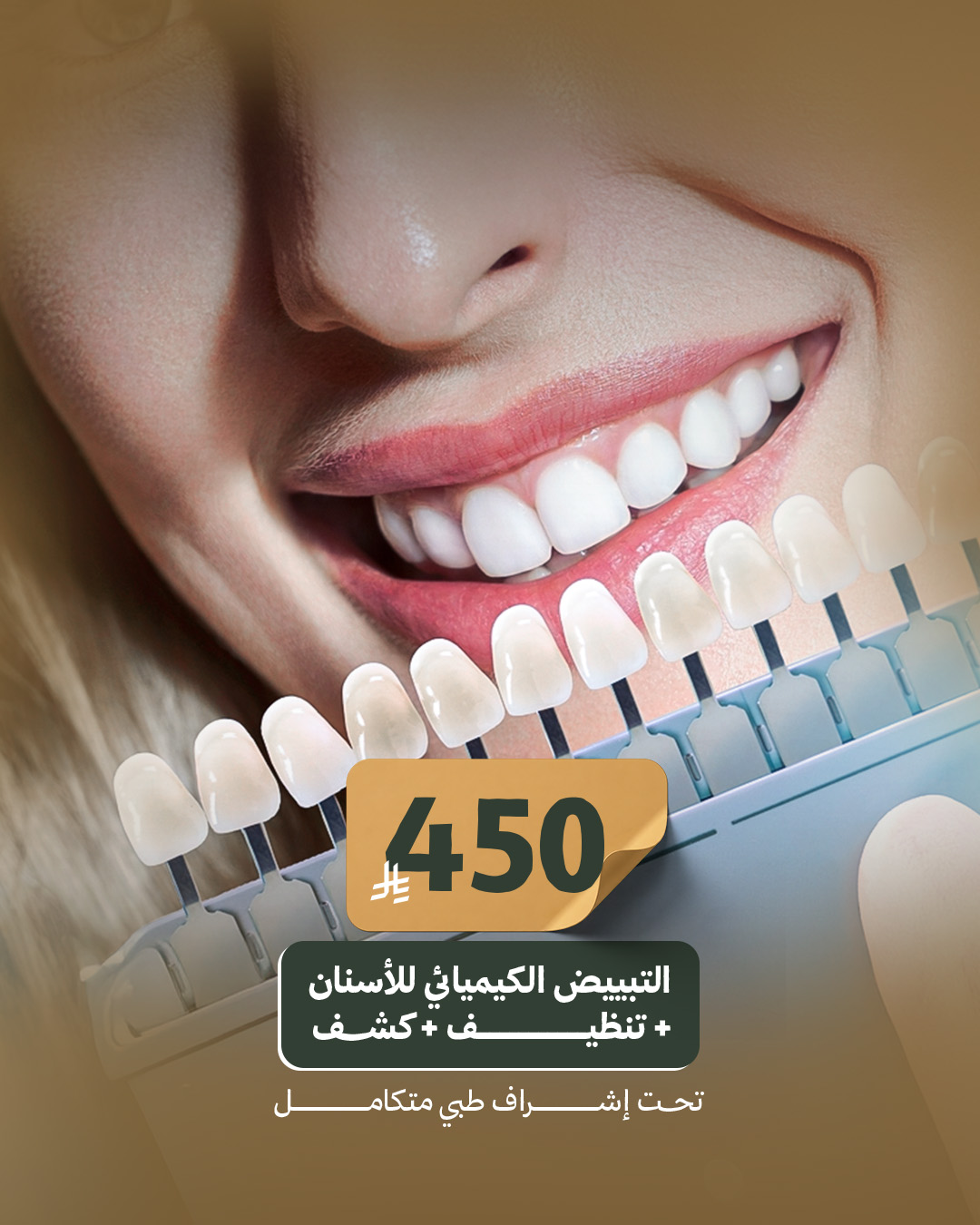 التبييض الكيميائي للأسنان+تنظيف+كشف