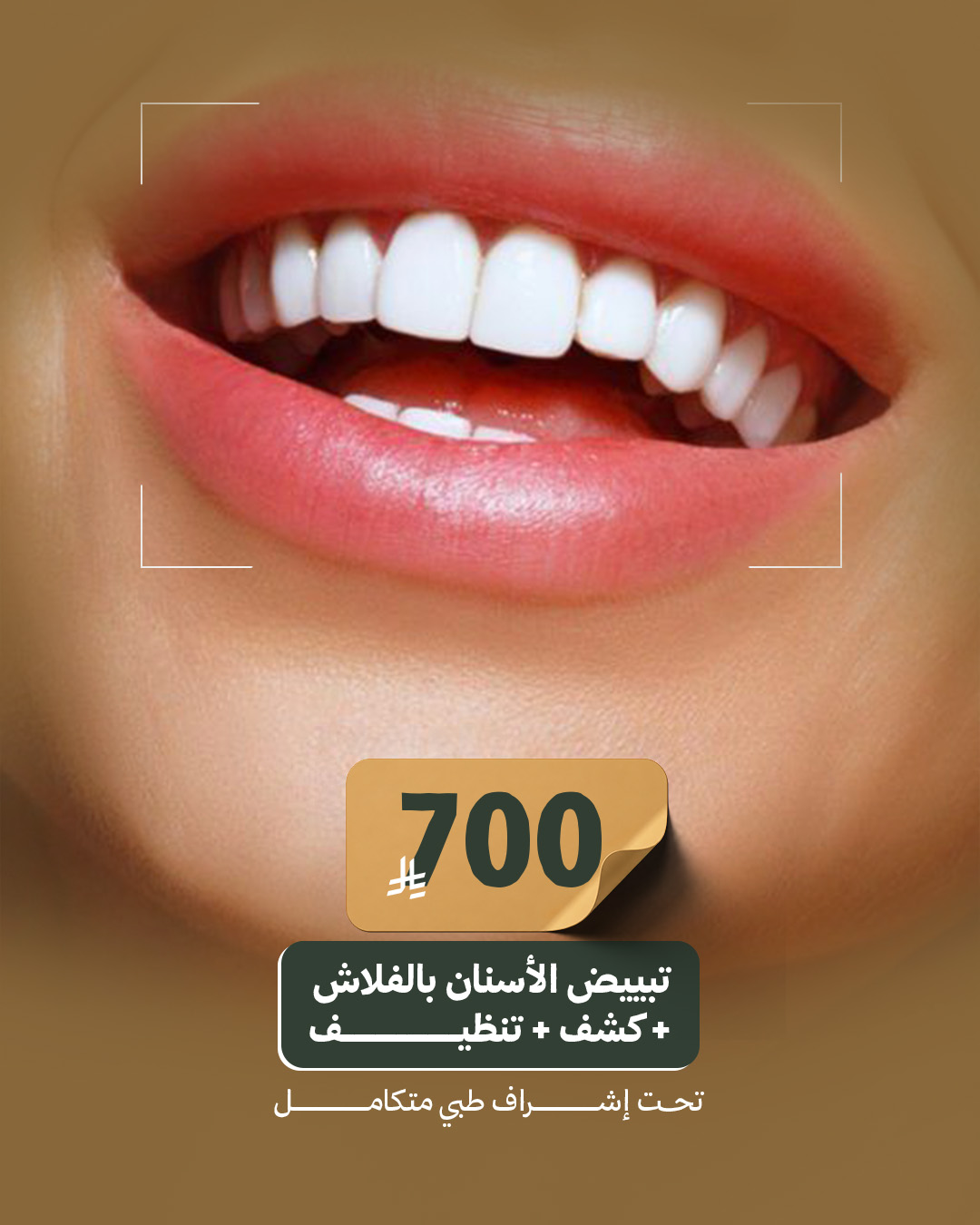 تبييض الأسنان بالفلاش + كشف + تنظيف
