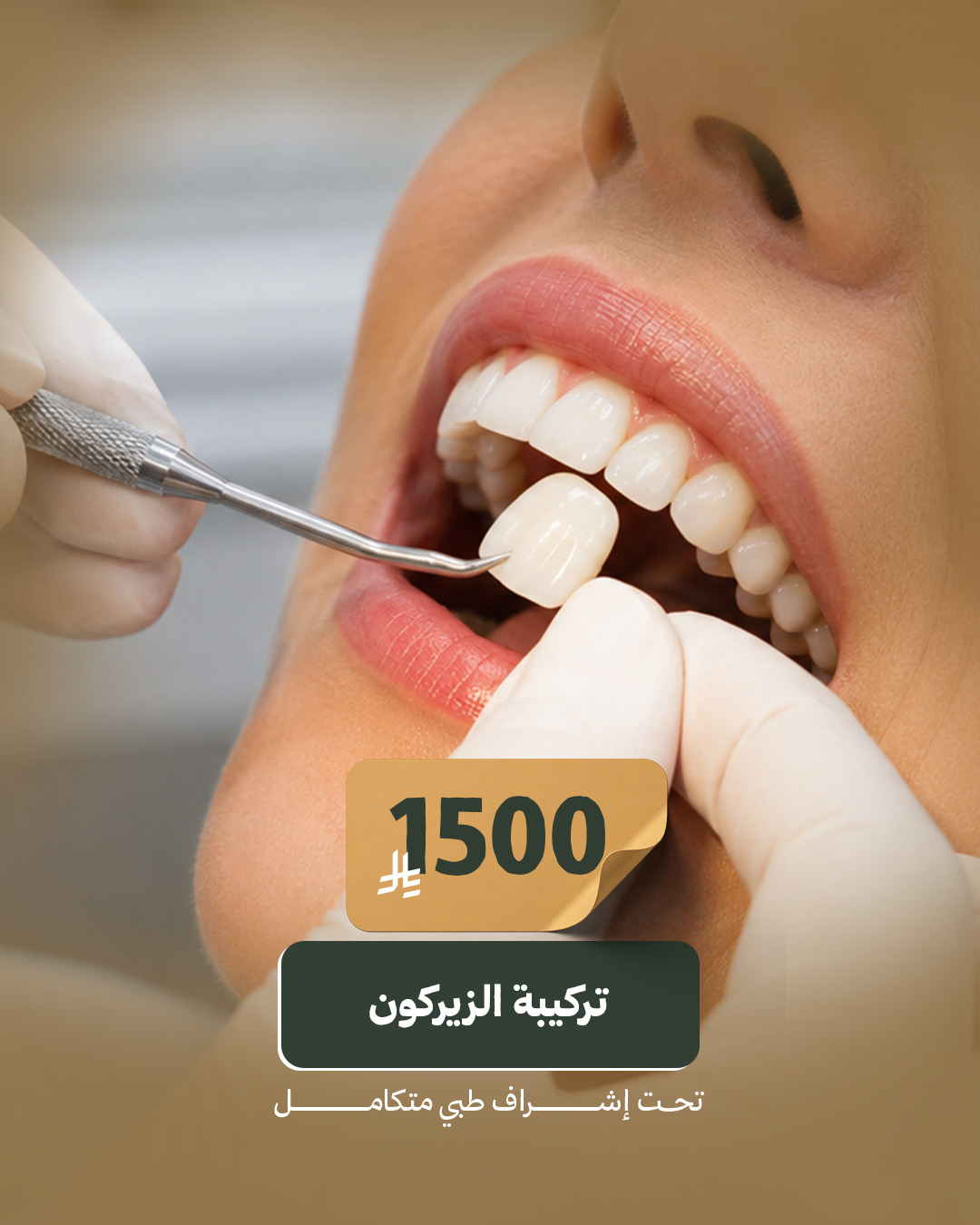 تركيبة الزيركون