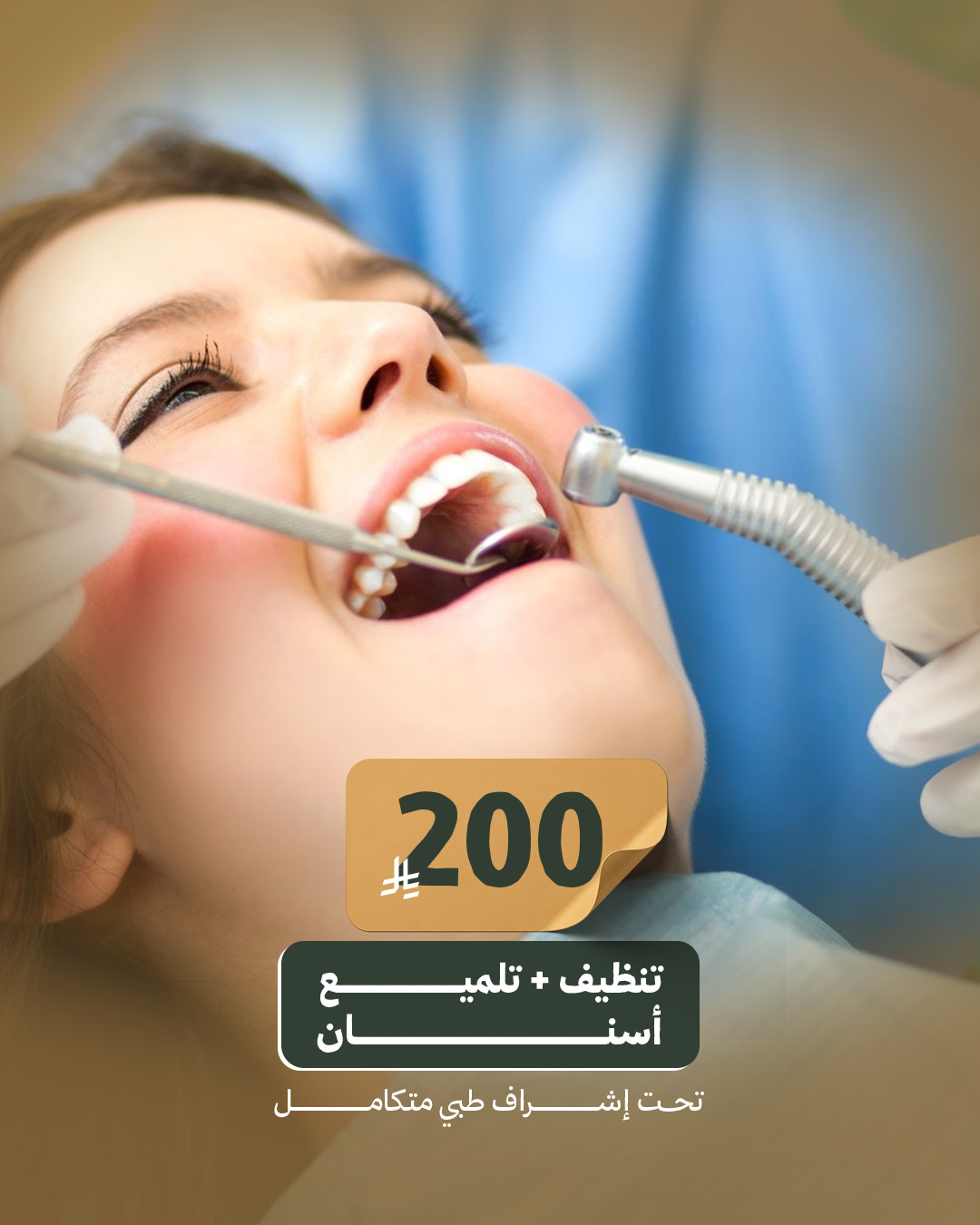 تنظيف+ تلميع اسنان