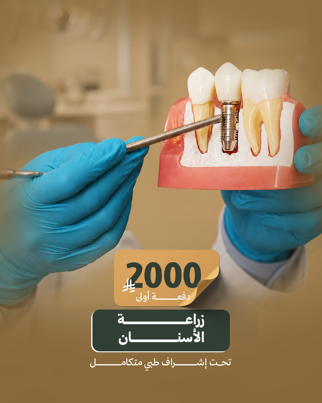 زراعة الأسنان